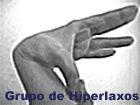 Hiperlaxitud Articular-Fibromialgia